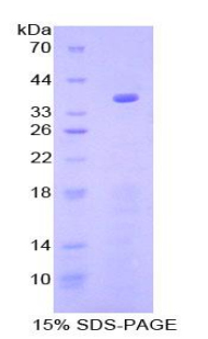 Recombinant Glycogen Synthase Kinase 3 Alpha (GSK3a)