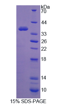 Recombinant Glycogen Synthase Kinase 3 Alpha (GSK3a)