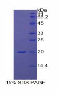 Recombinant Midkine (MK)