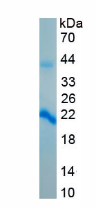 Recombinant Platelet Derived Growth Factor BB (PDGF BB)