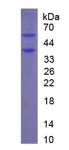 Recombinant Platelet Derived Growth Factor BB (PDGF BB)