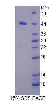 Recombinant Complement Factor H (CFH)