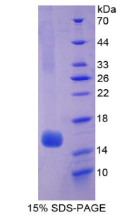 Recombinant Hexosaminidase B Beta (HEXb)