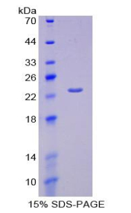 Recombinant Hexosaminidase B Beta (HEXb)