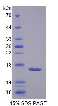 Recombinant Hexosaminidase B Beta (HEXb)