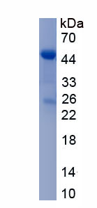Recombinant CCAAT/Enhancer Binding Protein Alpha (CEBPa)