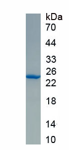 Recombinant Receptor For Advanced Glycation Endproducts (RAGE)