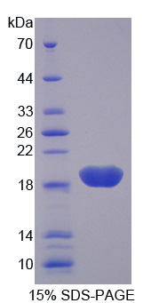 Recombinant Receptor For Advanced Glycation Endproducts (RAGE)