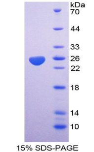 Recombinant Complement component 1 Q subcomponent-binding protein, mitochondrial (C1QBP)