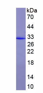 Recombinant Complement component 1 Q subcomponent-binding protein, mitochondrial (C1QBP)