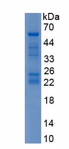 RPA653Hu01.jpg