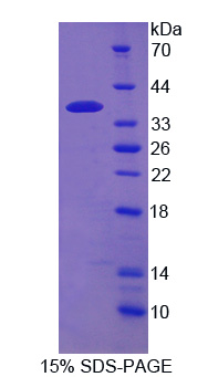 Recombinant Calcium/Calmodulin Dependent Protein Kinase II Gamma (CAMK2g)