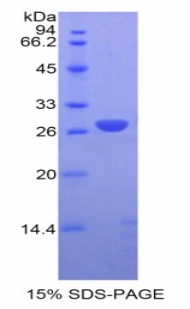 Recombinant Glutathione S Transferase Mu 1 (GSTM1)