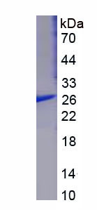 Recombinant Glutathione S Transferase Mu 1 (GSTM1)