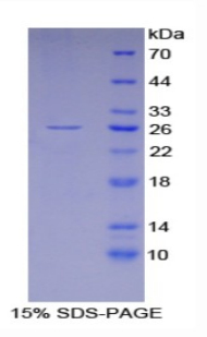 Recombinant Glutathione S Transferase A4 (GSTA4)