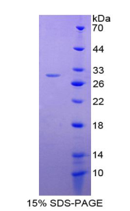 Recombinant Glutathione S Transferase A4 (GSTA4)