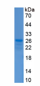 Recombinant Dopamine Receptor D2 (DRD2)