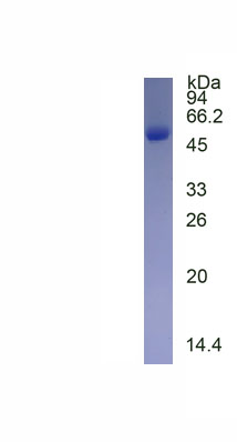 Recombinant Dopamine Receptor D2 (DRD2)