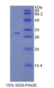 RPA675Hu02.jpg