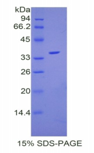 Recombinant Coagulation Factor V (F5)