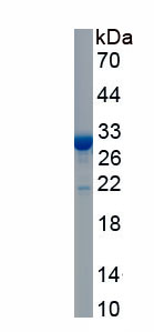 Recombinant Coagulation Factor V (F5)