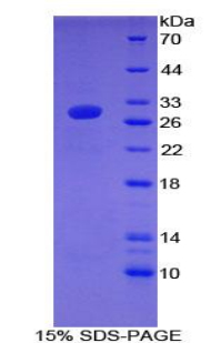 Recombinant Coagulation Factor XII (F12)