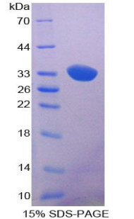 Recombinant Protein Kinase, AMP Activated Alpha 1 (AMPK Alpha 1)