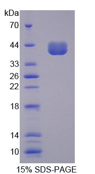 Recombinant Cluster Of Differentiation 14 (CD14)