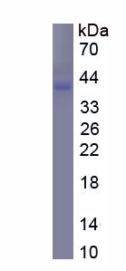 Recombinant Procalcitonin (PCT)