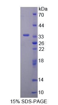 RPA690Hu01.jpg