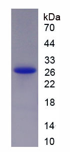 Recombinant Heat Shock Protein 27 (Hsp27)