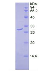 Recombinant Dihydrolipoyl Transacetylase (DLAT)