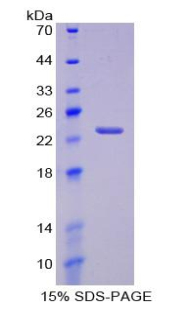 Recombinant Cyclooxygenase-2 (COX 2)