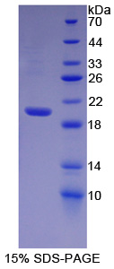 Recombinant Heparanase (HPSE)