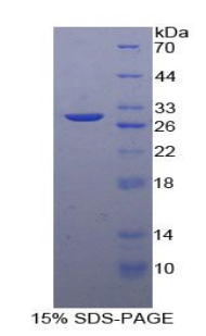 Recombinant Sodium/potassium Transporting ATPase Subunit Beta-3 (ATP1b3)