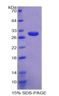 Recombinant Sodium/potassium Transporting ATPase Subunit Beta-3 (ATP1b3)