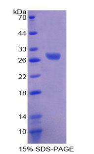 Recombinant Sodium/potassium Transporting ATPase Subunit Beta-3 (ATP1b3)