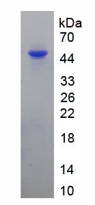 Recombinant Hypoxanthine Phosphoribosyltransferase 1 (HPRT1)