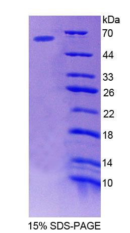 Recombinant Beta-Site APP Cleaving Enzyme 1 (bACE1)