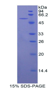 Recombinant Beta-Site APP Cleaving Enzyme 1 (bACE1)