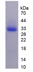 Recombinant Glucose 6 Phosphate Isomerase (GPI)