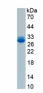 Recombinant Glucose 6 Phosphate Isomerase (GPI)