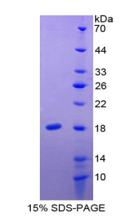 Recombinant Prealbumin (PALB)