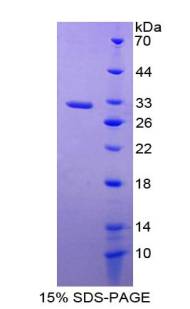 Recombinant Cyclooxygenase 1 (COX-1)