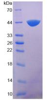 Recombinant Complement Component 7 (C7)