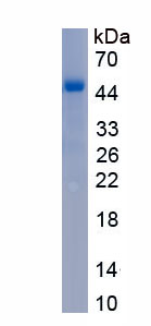 Recombinant Protein C (PROC)