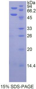 Recombinant Protein C (PROC)