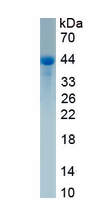 Recombinant Protein C (PROC)