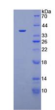 Recombinant Cyclin Dependent Kinase 5 (CDK5)