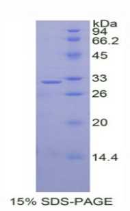 Recombinant Dickkopf Related Protein 1 (DKK1)